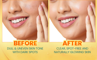 Himalaya Turmeric & Vitamin C Dark Spot Reduction serums